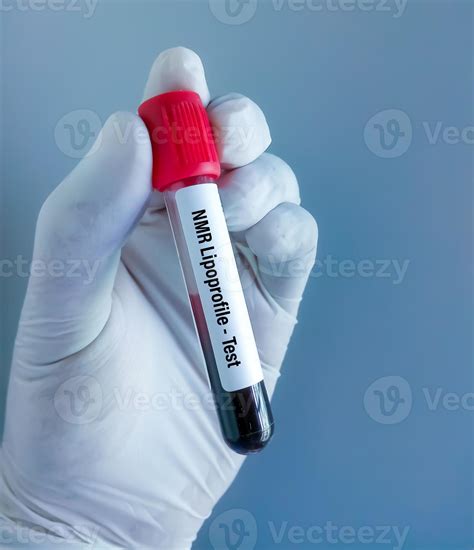 Blood sample for NMR Lipoprofile test. 12601185 Stock Photo at Vecteezy