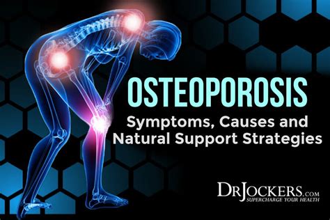 Osteoporosis symptoms causes and natural support strategies – Artofit