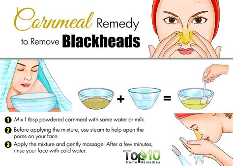 Home Remedies to Get Rid of Blackheads Fast | Top 10 Home Remedies