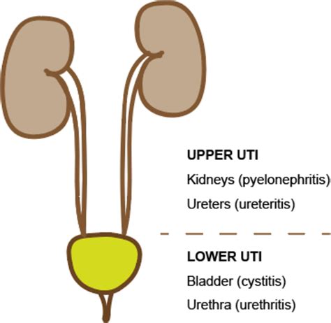 Urinary tract infections in children: an overview of diagnosis and management | BMJ Paediatrics Open