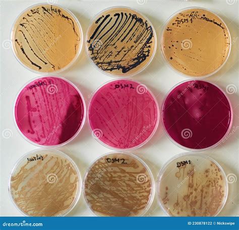 Bacteria Colonies on Selective Media Agar Plates in Various Petri Dish Stock Photo - Image of ...