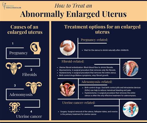 Enlarged Uterus Treatments in Downtown Brooklyn, NY - Downtown Vein ...