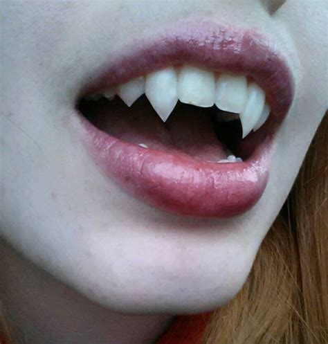 Vampire Fangs Diy | cirugiaplasticayalgomas