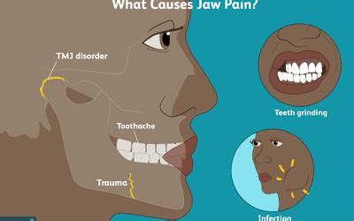 How To Get Rid Of Lockjaw Fast - change comin