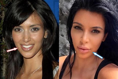 Kardashians before and after photos