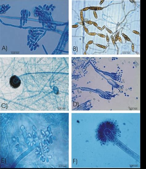 Fusarium Under Microscope