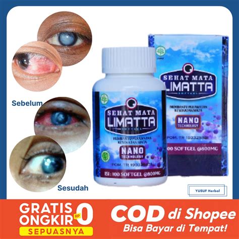 Jual Obat Retina Mata Rusak - Mata Berkabut - Buram - Ulkus Kornea Mata ...