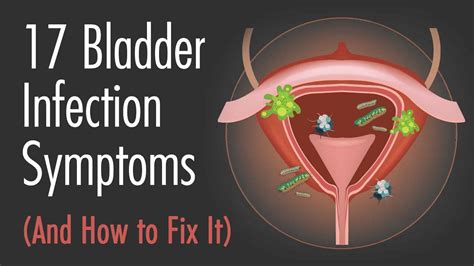 17 Bladder Infection Symptoms (And How to Fix It)