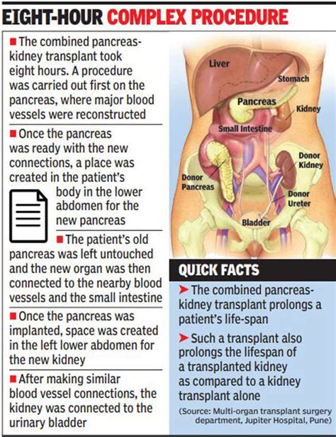 Pune: Pancreas-kidney transplant reverses businessman’s diabetes | Pune News - Times of India