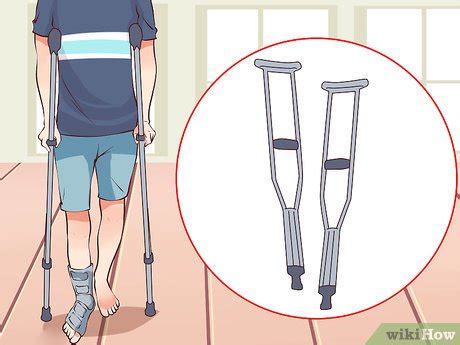 How to Recover From Plantar Fasciitis Surgery: 15 Steps