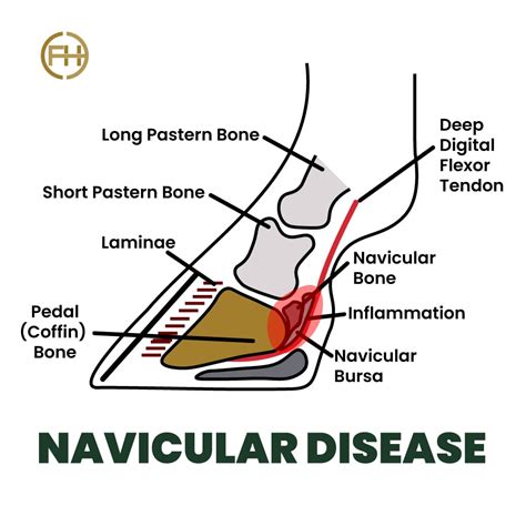 Complete Guide on Navicular Disease in Horses - FormaHoof