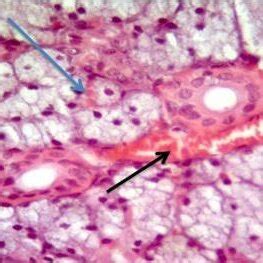 A section of a submandibular salivary gland of a rabbit of Group 2 ...