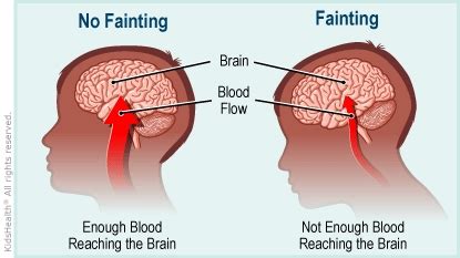 Az Symptoms Fainting | Dayton Children's