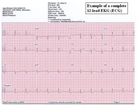 eHeart: Introduction to ECG EKG