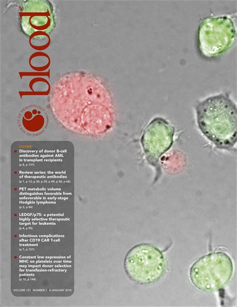 Cabot rings and marked anisopoikilocytosis in Imerslund-Gräsbeck ...