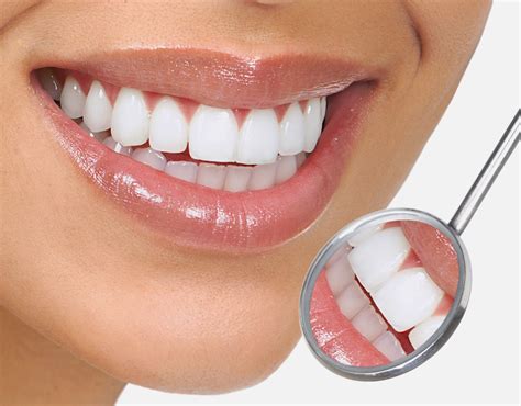 Protect Your Smile - 6 Teeth Whitening Remedies You Should Consider - Universal Science Compendium