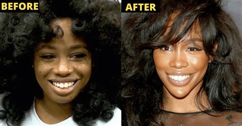 Fans Believe Sza Had Plastic Surgery, Reveal Photos Of Sza Before Surgery - Trendzified