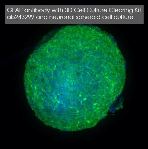 Anti-GFAP antibody (ab7260) | Abcam