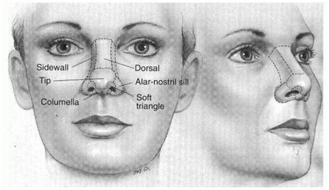 The Nasal Dorsum: Management of the Upper Two-Thirds of the Nose | Ento Key | Nose, Management ...