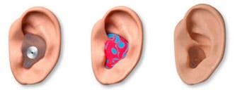 Custom Ear Molds Offer Full Protection And Preserves Hearing