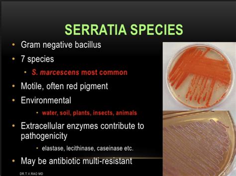 serratia Diagram | Quizlet