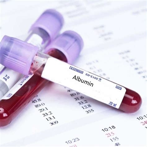 Albumin function, albumin levels and causes of high or low albumin levels