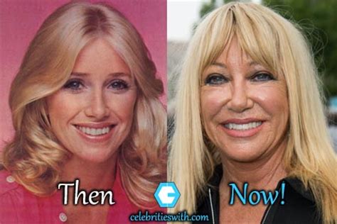 Suzanne Somers Plastic Surgery, Facelift, Boob Job Before After Pics - CelebritiesWith.com