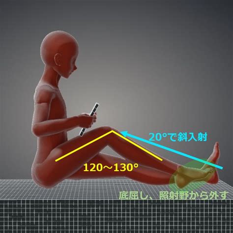 膝関節軸位撮影 Knee joint axial view, sunrise view, skyline view, Laurin view｜Tools for RadTech