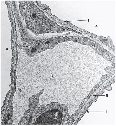 Ultrastructure of the blood- air barrier Diagram | Quizlet