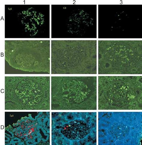 Immunofluorescence observation and comparison. A: FITC-fluorescence in ...