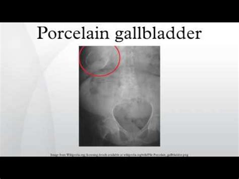 Porcelain gallbladder - YouTube