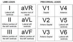 EKG Flashcards - Cram.com