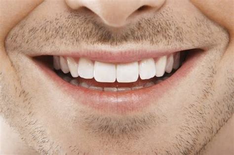 Vuelve a sonreir con estas 5 efectivas formas de blanquear tus dientes ...