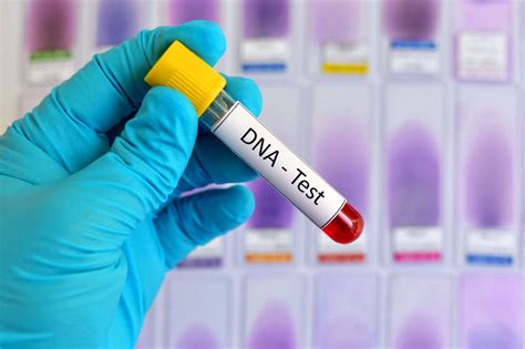 DNA Testing – Dr. Jones MD