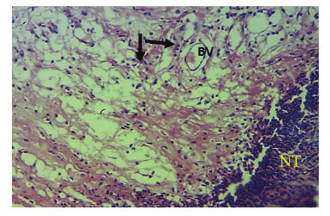 Necrotic tissue seen at wound surface(NT) ,blood islands(arrows). H&Ex20 | Download Scientific ...