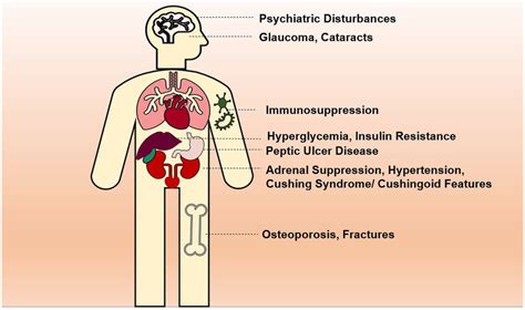 Side effects of chronic use of corticosteroids. | Download Scientific ...