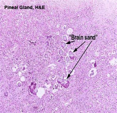 Pineal Gland Histology Labeled