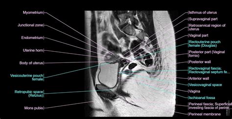 Female pelvis: normal anatomy | e-Anatomy