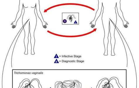 Laboratory diagnosis of Trichomonas vaginalis infections - Learn ...