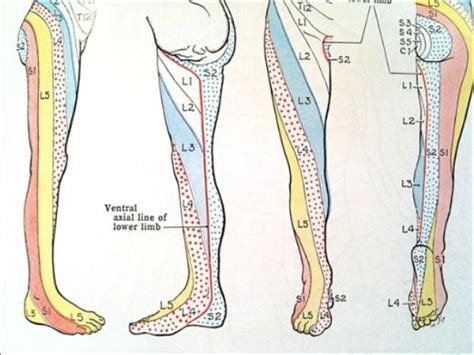 Dermatomes Netter