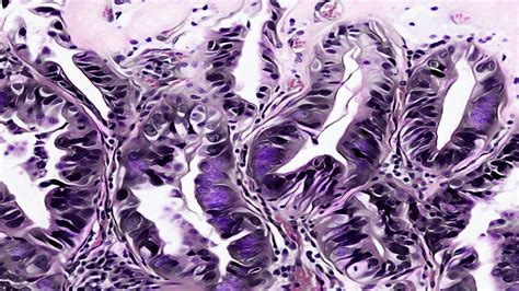 Check out Hematoxylin And Eosin Staining Protocol | Laboratory Hub