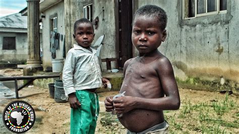 Hungry Children In Africa - Weeks left to save East Africa's starving children: World ...