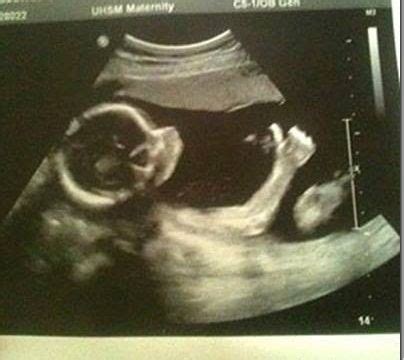 Cool Ultrasound, Bro. | Funny babies, Baby ultrasound, Funny