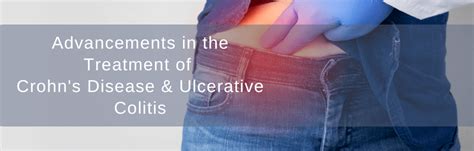 Advancements in the Treatment of Crohn's Disease & Ulcerative Colitis