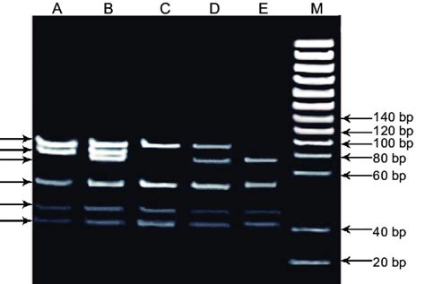 Gel electrophoresis of APOE genotypes following Hha I restriction... | Download Scientific Diagram