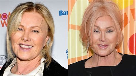 Deborra-Lee Furness' Plastic Surgery: She Looked Young As Ever in Met ...