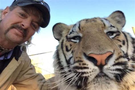 Tiger King John Finlay: Photos before and after he got his teeth fixed.