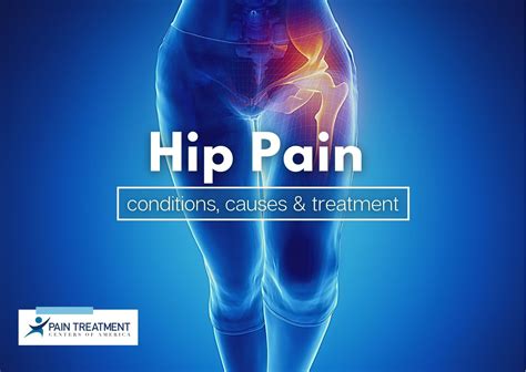 An Overview of Hip Pain: Conditions, Causes & Treatment | PTCOA