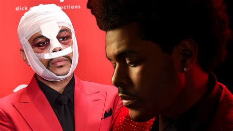 The Weeknd REVEALS Meaning Of Face Transformation & Bandages Ahead Of Superbowl!