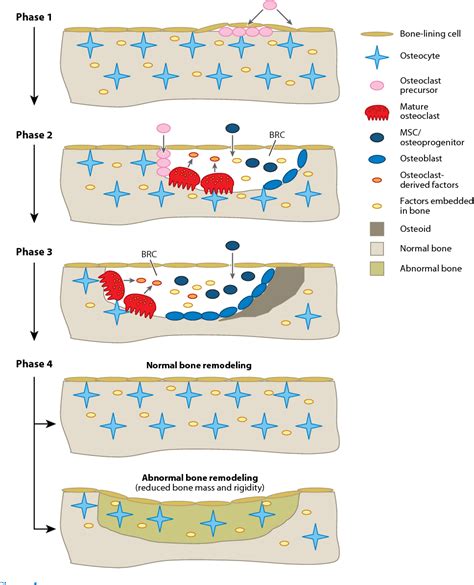 Figure 1 from Disorders of bone remodeling. | Semantic Scholar